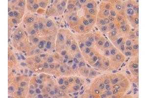 Detection of DNASE1 in Human Liver Tissue using Polyclonal Antibody to Deoxyribonuclease I (DNASE1)