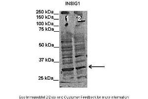 Lanes:   Lane1: 50 ug human putamen lysate Lane2: 50 ug rat cortex lysate  Primary Antibody Dilution:   1:1000  Secondary Antibody:   Mouse anti-rabbit HRP  Secondary Antibody Dilution:   1:15000  Gene Name:   INSIG1  Submitted by:   Anonymous