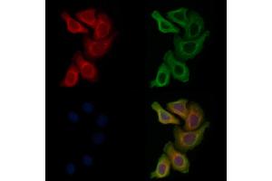 ABIN6262809 and ABIN6278267 staining Hela cells by IF/ICC.