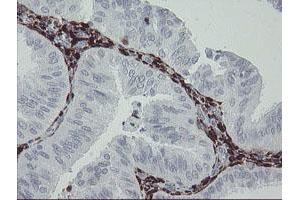 Image no. 7 for anti-Coagulation Factor XIII, A1 Polypeptide (F13A1) antibody (ABIN1498150)