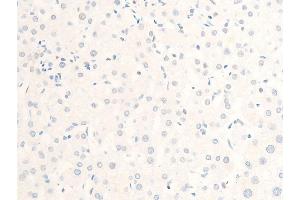 ABIN6267244 at 1/100 staining human liver tissue sections by IHC-P.