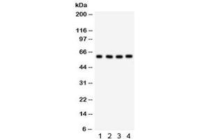Western blot testing of 1) human placenta, 2) HepG2, 3) 293 and 4) HeLa lysate with HRPT2 antibody. (HRPT2 anticorps  (AA 119-520))