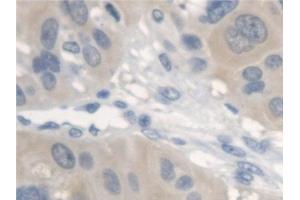 Detection of ErbB4 in Human Esophagus Tissue using Polyclonal Antibody to Erb-b2 Receptor Tyrosine Kinase 4 (ErbB4)