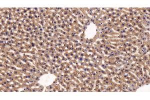 Detection of FUR in Mouse Liver Tissue using Polyclonal Antibody to Furin (FUR) (FURIN anticorps  (AA 418-573))