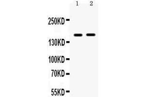Observed bind size: 160KD (HDAC6 anticorps  (N-Term))