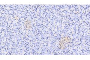 Detection of XRN1 in Human Pancreas Tissue using Polyclonal Antibody to 5'-3'Exoribonuclease 1 (XRN1) (XRN1 anticorps  (AA 1394-1706))