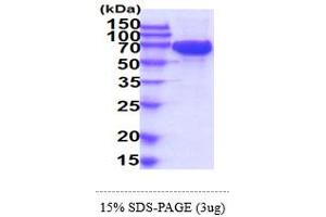 SDS-PAGE (SDS) image for Mast/stem Cell Growth Factor Receptor (KIT) (AA 26-524) protein (His tag) (ABIN5854993)