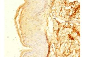 Immunohistochemistry of paraffin-embedded human skin tissue using ABIN7176351 at dilution of 1:100 (ZNF513 anticorps  (AA 1-300))