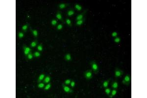 Detection of NUP50 in Hela cells using Polyclonal Antibody to Nucleoporin 50 kDa (NUP50)