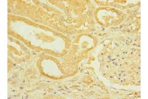 Immunohistochemistry of paraffin-embedded human kidney tissue using ABIN7168444 at dilution of 1:100 (ROBO2 anticorps  (AA 450-660))