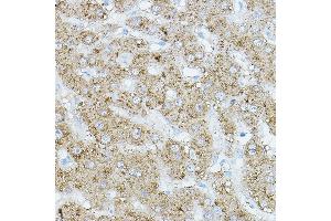 Immunohistochemistry of paraffin-embedded human liver using EIF2 Rabbit pAb (ABIN6131600, ABIN6140021, ABIN6140022 and ABIN6218371) at dilution of 1:500 (40x lens). (EIF2AK1 anticorps  (AA 371-630))