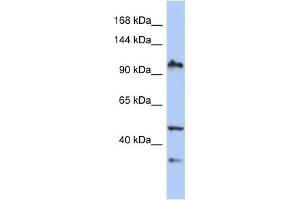 WB Suggested Anti-XAB2 Antibody Titration:  0. (XAB2 anticorps  (N-Term))