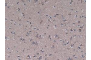 Detection of C5a in Human Cerebrum Tissue using Polyclonal Antibody to Complement Component 5a (C5a)