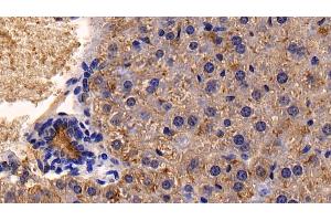 Detection of CD26 in Mouse Liver Tissue using Polyclonal Antibody to Cluster Of Differentiation 26 (CD26) (DPP4 anticorps  (AA 631-760))