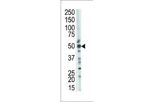 The anti-TSABIN486223 and ABIN1535604 Pab (ABIN388926 and ABIN2839200) is used in Western blot to detect TSABIN486223 and ABIN1535604 in mouse kidney tissue lysate.