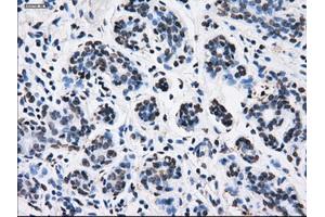 Immunohistochemical staining of paraffin-embedded breast tissue using anti-RPA2 mouse monoclonal antibody. (RPA2 anticorps)