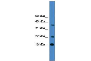 WB Suggested Anti-CASP4 Antibody Titration: 0. (Caspase 4 anticorps  (Middle Region))