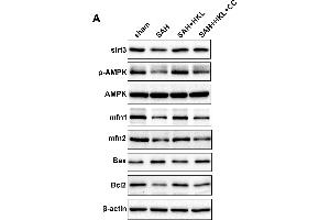 SIRT3 protected mitochondrial fusion proteins Mfn1 and Mfn2 after SAH in an AMPK-dependent manner. (MFN1 anticorps  (AA 622-741))
