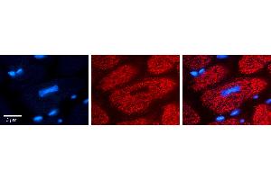 Rabbit Anti-FPGS Antibody Catalog Number: ARP63438_P050 Formalin Fixed Paraffin Embedded Tissue: Human heart Tissue Observed Staining: Cytoplasmic in mitochondria Primary Antibody Concentration: N/A Other Working Concentrations: 1:600 Secondary Antibody: Donkey anti-Rabbit-Cy3 Secondary Antibody Concentration: 1:200 Magnification: 20X Exposure Time: 0. (FPGS anticorps  (Middle Region))