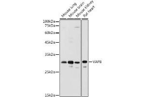 Western blot analysis of extracts of various cell lines, using VAPB antibody (ABIN6132783, ABIN6150058, ABIN6150059 and ABIN6221003) at 1:1000 dilution. (VAPB anticorps  (AA 10-222))