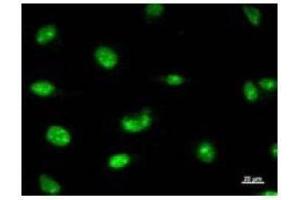 Immunostaining analysis in HeLa cells.