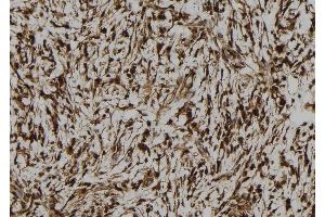 ABIN6261026 and ABIN6273105 at 1/100 staining Human gastric tissue by IHC-P. (CREB3L1 anticorps  (N-Term))