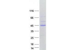 Validation with Western Blot
