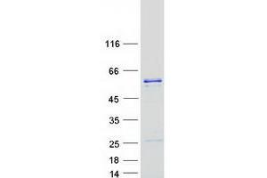 Validation with Western Blot