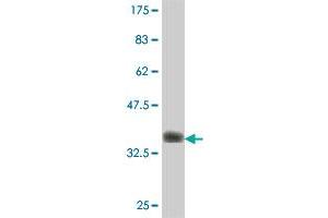 Western Blot detection against Immunogen (37.