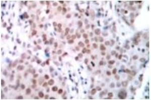 Image no. 1 for anti-Estrogen Receptor 1 (ESR1) (pSer104) antibody (ABIN318016) (Estrogen Receptor alpha anticorps  (pSer104))