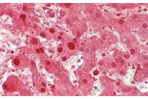 Detection of ALT in Human Liver Tissue using Polyclonal Antibody to Alanine Aminotransferase (ALT)
