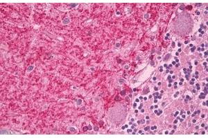 Image no. 2 for anti-Cannabinoid Receptor 1 (CNR1) (AA 73-122) antibody (ABIN6749772)