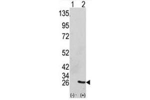 Western blot analysis of GRB2 antibody and 293 cell lysate (2 ug/lane) either nontransfected (Lane 1) or transiently transfected with the GRB2 gene (2).