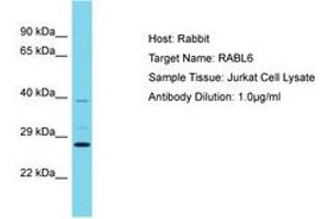 Image no. 1 for anti-KIAA1984 (KIAA1984) (AA 67-116) antibody (ABIN6750638) (CCDC183/KIAA1984 anticorps  (AA 67-116))