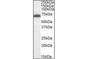 Antibody (1 µg/ml) staining of Mouse Brain lysate (35 µg protein in RIPA buffer). (GAD anticorps  (Internal Region))