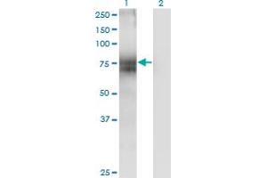 Western Blot analysis of ITM1 expression in transfected 293T cell line by ITM1 monoclonal antibody (M02), clone 4D4.