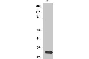 Western Blotting (WB) image for anti-N/H/K-Ras antibody (ABIN5956741) (N/H/K-Ras anticorps)