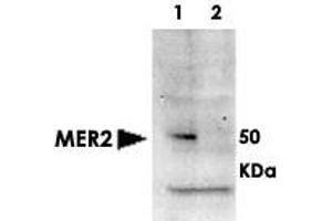 Western blot using MER2 (phospho S30) polyclonal antibody  shows detection of phosphorylated MER2 in whole cell extracts. (CD151 anticorps  (pSer30))