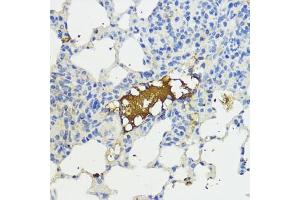 Immunohistochemistry of paraffin-embedded mouse lung using Complement factor B (CFB) antibody (ABIN3015549, ABIN3015550, ABIN3015551, ABIN1679188 and ABIN6218807) at dilution of 1:200 (40x lens). (Complement Factor B anticorps  (AA 80-420))