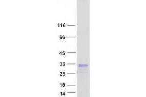 Validation with Western Blot (Ly6k Protein (Myc-DYKDDDDK Tag))