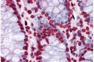 Human Colon: Formalin-Fixed, Paraffin-Embedded (FFPE) (HIPK1 anticorps  (AA 330-430))