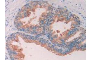 IHC-P analysis of Human Prostate Gland Tissue, with DAB staining. (SERPINA6 anticorps  (AA 218-378))