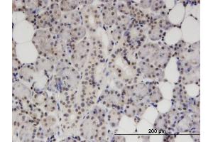 Immunoperoxidase of monoclonal antibody to S100B on formalin-fixed paraffin-embedded human salivary gland.