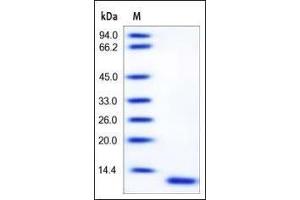 Human S100A6, Tag Free on SDS-PAGE under reducing (R) condition. (S100A6 Protein (AA 1-90))