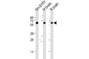 All lanes : Anti-DPYL5 Antibody at 1:4000 dilution Lane 1: SH-SY5Y whole cell lysates Lane 2: mouse brain lysates Lane 3: rat brain lysates Lysates/proteins at 20 μg per lane. (DPYSL5 anticorps)