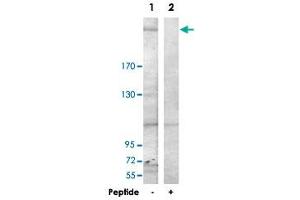 Western blot analysis of extracts from HepG2 cells, using LAMB1 polyclonal antibody . (Laminin beta 1 anticorps  (C-Term))