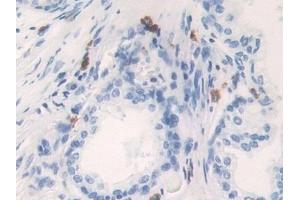 Detection of KLK6 in Human Prostate Tissue using Polyclonal Antibody to Kallikrein 6 (KLK6)