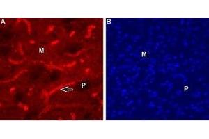 Expression of Muscarinic acetylcholine receptor M1 in mouse striatum - Immunohistochemical staining of mouse striatum using Anti-CHRM1 (443-458) Antibody (ABIN7043061, ABIN7044590 and ABIN7044591), (1:100).