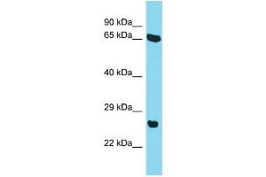 Host: Rabbit Target Name: C22orf23 Sample Type: HepG2 Whole Cell lysates Antibody Dilution: 1. (C22orf23 anticorps  (Middle Region))