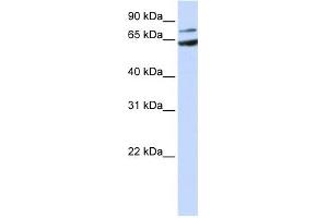 FZD8 antibody used at 1 ug/ml to detect target protein. (FZD8 anticorps)